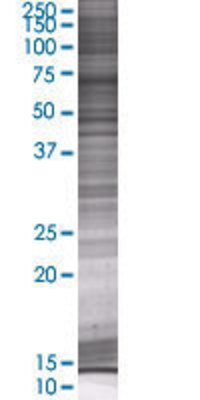 C4BPA transfected lysate.