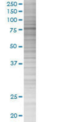 FBXO40 transfected lysate.