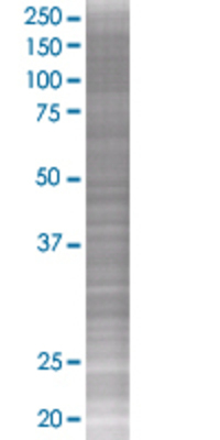 WNT7B transfected lysate.