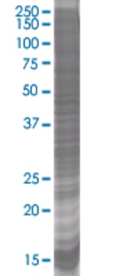 SNRPN transfected lysate