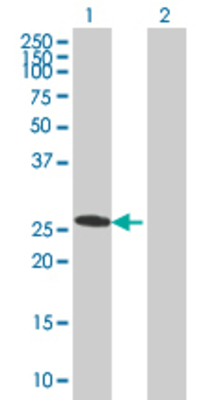 Lane 1: SNRPN transfected lysate (26.51 KDa). Lane 2: Non-transfected lysate.
