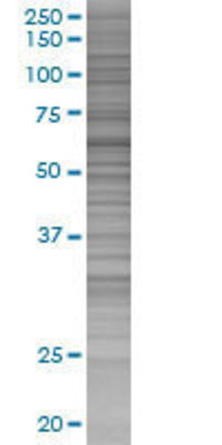 SUOX transfected lysate.