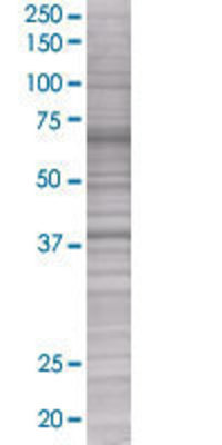 MSI1 transfected lysate.
