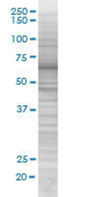 IRAK3 transfected lysate.