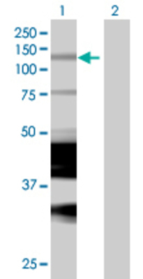 Lane 1: LITAF transfected lysate (17.1 KDa) Lane 2: Non-transfected lysate.