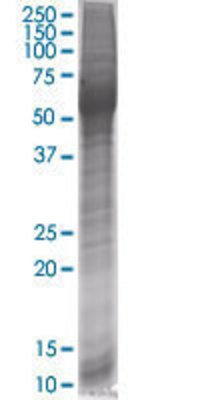 FABP4 transfected lysate