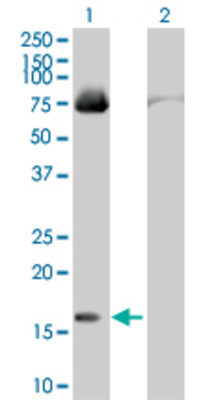 Lane 1: FABP4 transfected lysate (14.63 KDa). Lane 2: Non-transfected lysate.