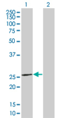 Lane 1: CERK transfected lysate (21.7 KDa) Lane 2: Non-transfected lysate.
