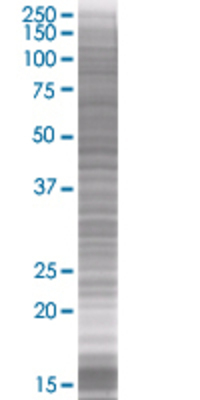 CERK transfected lysate.