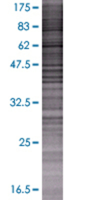 TSEN34 transfected lysate.