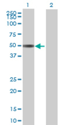 Lane 1: TSEN34 transfected lysate (43.01 KDa) Lane 2: Non-transfected lysate.