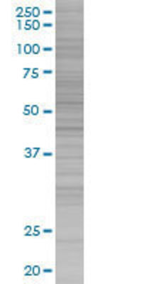 ENTPD3 transfected lysate.