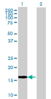 Lane 1: IFNA8 transfected lysate (20.9 KDa) Lane 2: Non-transfected lysate.