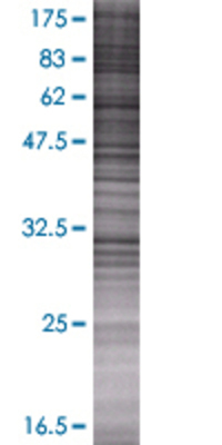 PYCR2 transfected lysate.