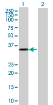 Lane 1: PYCR2 transfected lysate (35.31 KDa) Lane 2: Non-transfected lysate.