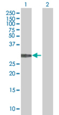 Lane 1: MED6 transfected lysate (27.17 KDa). Lane 2: Non-transfected lysate.