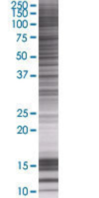 LPGAT1 transfected lysate.