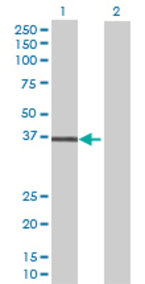 Lane 1: LPGAT1 transfected lysate (40.81 KDa) Lane 2: Non-transfected lysate.