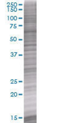 BDKRB1 transfected lysate