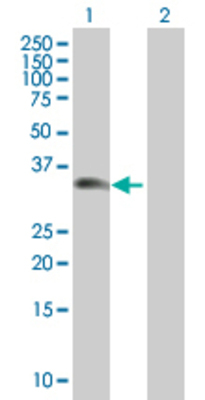 Lane 1: TPPP transfected lysate (24.09 KDa) Lane 2: Non-transfected lysate.