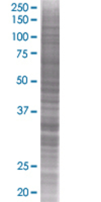 CCNH transfected lysate