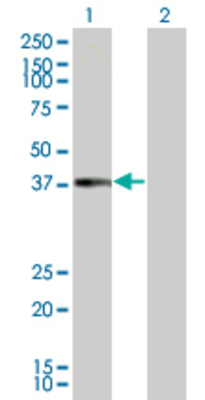 Lane 1: CCNH transfected lysate (37.6 KDa). Lane 2: Non-transfected lysate.