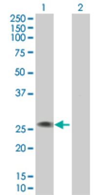 Lane 1: EVI2A transfected lysate (23.43 KDa). Lane 2: Non-transfected lysate.