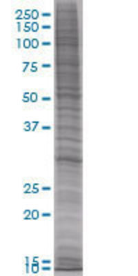 ORC6L transfected lysate