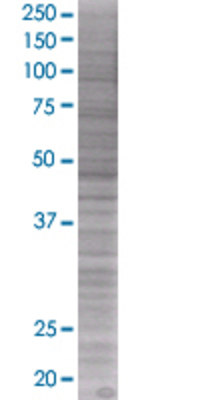 POLD2 transfected lysate.