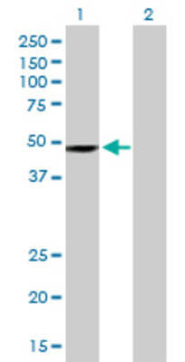 Lane 1: CHKA transfected lysate (50.38 KDa) Lane 2: Non-transfected lysate.