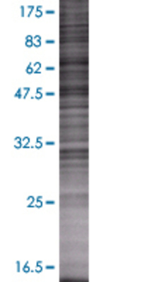 CHKA transfected lysate.