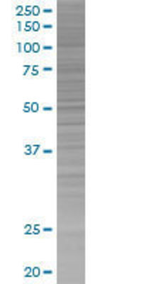 LYL1 transfected lysate.