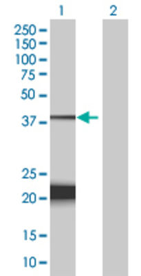 Lane 1: C1orf57 transfected lysate (20.7 KDa) Lane 2: Non-transfected lysate.