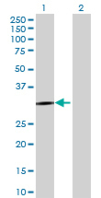 Lane 1: DHRS9 transfected lysate (35.2 KDa) Lane 2: Non-transfected lysate.