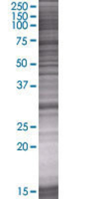 DHRS9 transfected lysate.