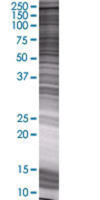 PRDM15 transfected lysate.