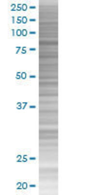 MYST2 transfected lysate.
