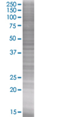 TREM1 transfected lysate.