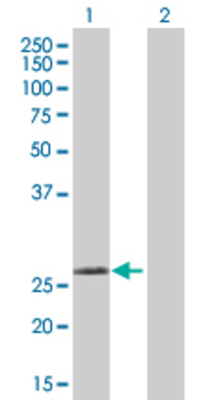 Lane 1: TREM1 transfected lysate (25.85 KDa) Lane 2: Non-transfected lysate.