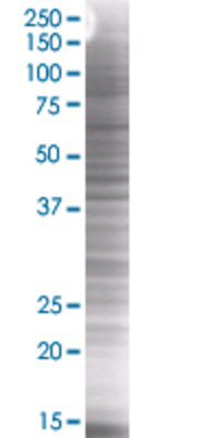NDFIP1 transfected lysate.
