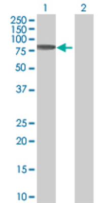 Lane 1: RPA1 transfected lysate (68.1 KDa) Lane 2: Non-transfected lysate.
