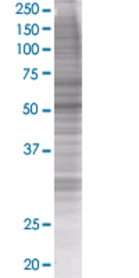 CTBP2 transfected lysate.