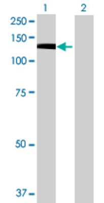 Lane 1: PTK2B transfected lysate (111.1 KDa) Lane 2: Non-transfected lysate.
