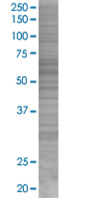 RGS7 transfected lysate