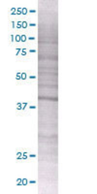 SERPINB2 transfected lysate.
