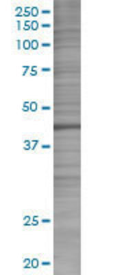 ACTR1B transfected lysate.