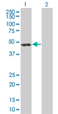 Lane 1: ACTR1B transfected lysate (41.47 KDa) Lane 2: Non-transfected lysate.