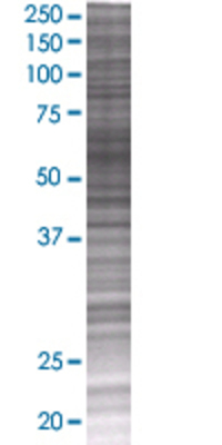 SMAD6 transfected lysate.