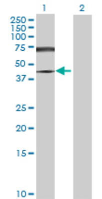 Lane 1: SMAD6 transfected lysate (54.67 KDa) Lane 2: Non-transfected lysate.