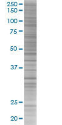 ANXA3 transfected lysate.